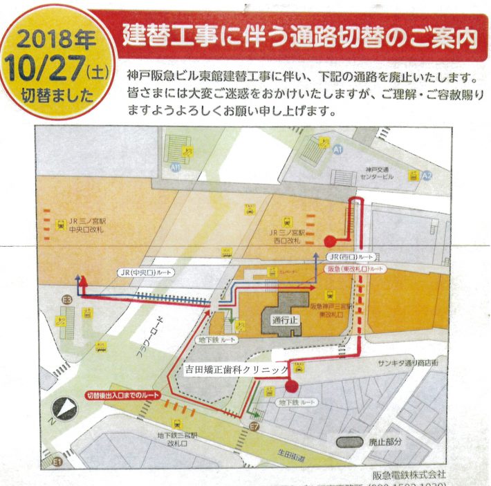 クリニック前で阪急ビル建替工事中のため一部通路が閉鎖されています 地図をご参考下さい 神戸 三宮駅前の吉田矯正歯科クリニック